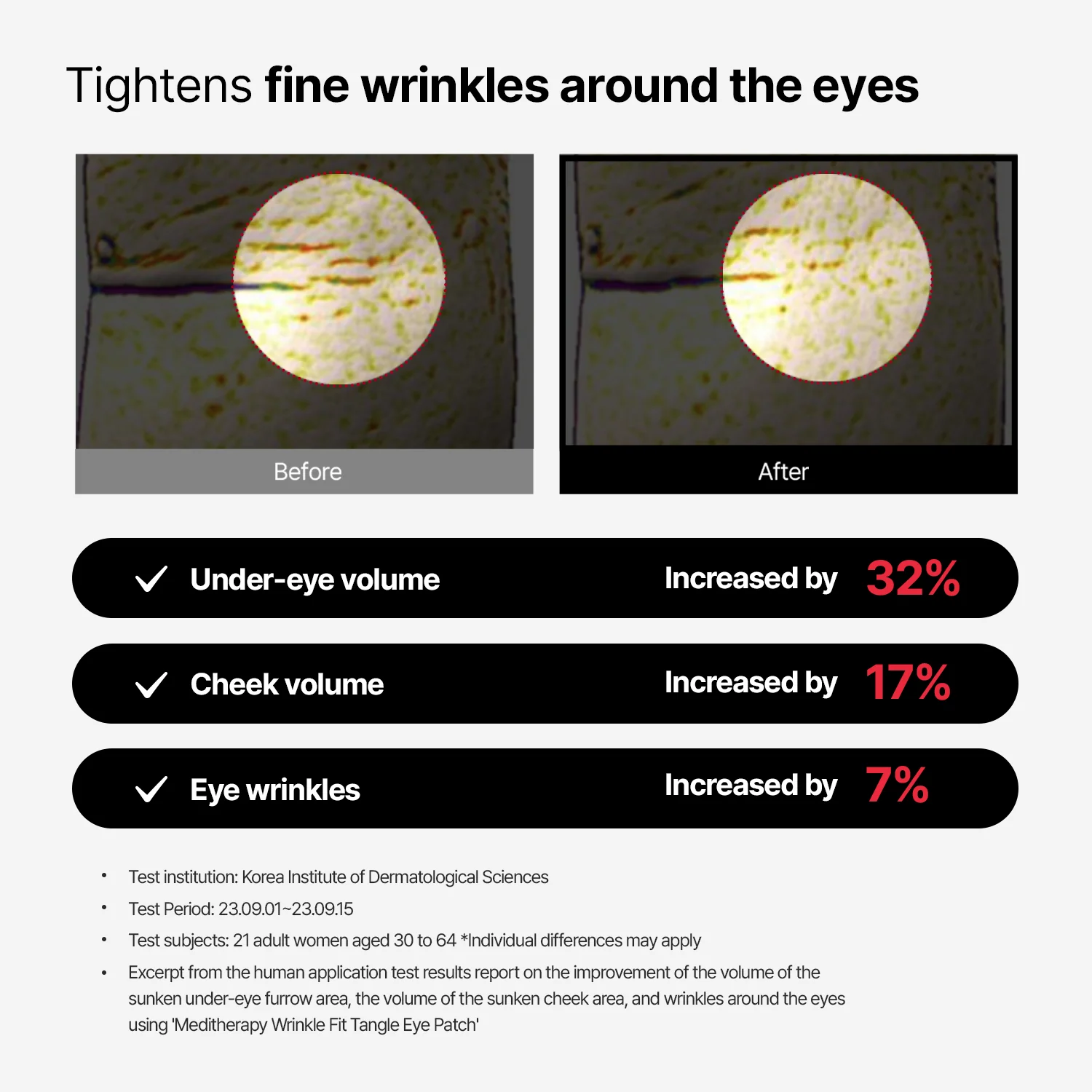 Collagen Wrinkle-fit Tangle Eye Patch - Image 3