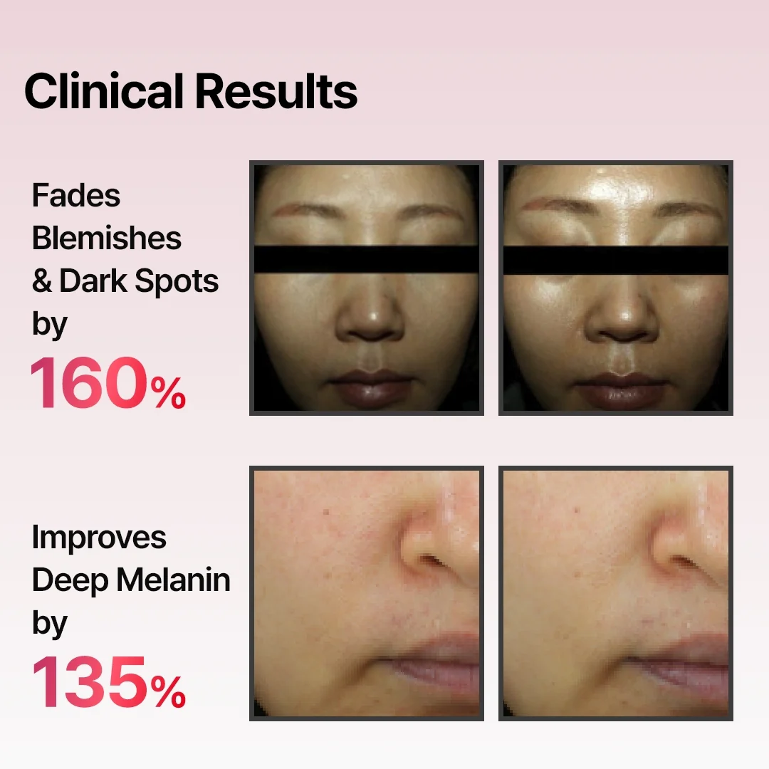 Arbutin Skin Booster Serum - Image 4