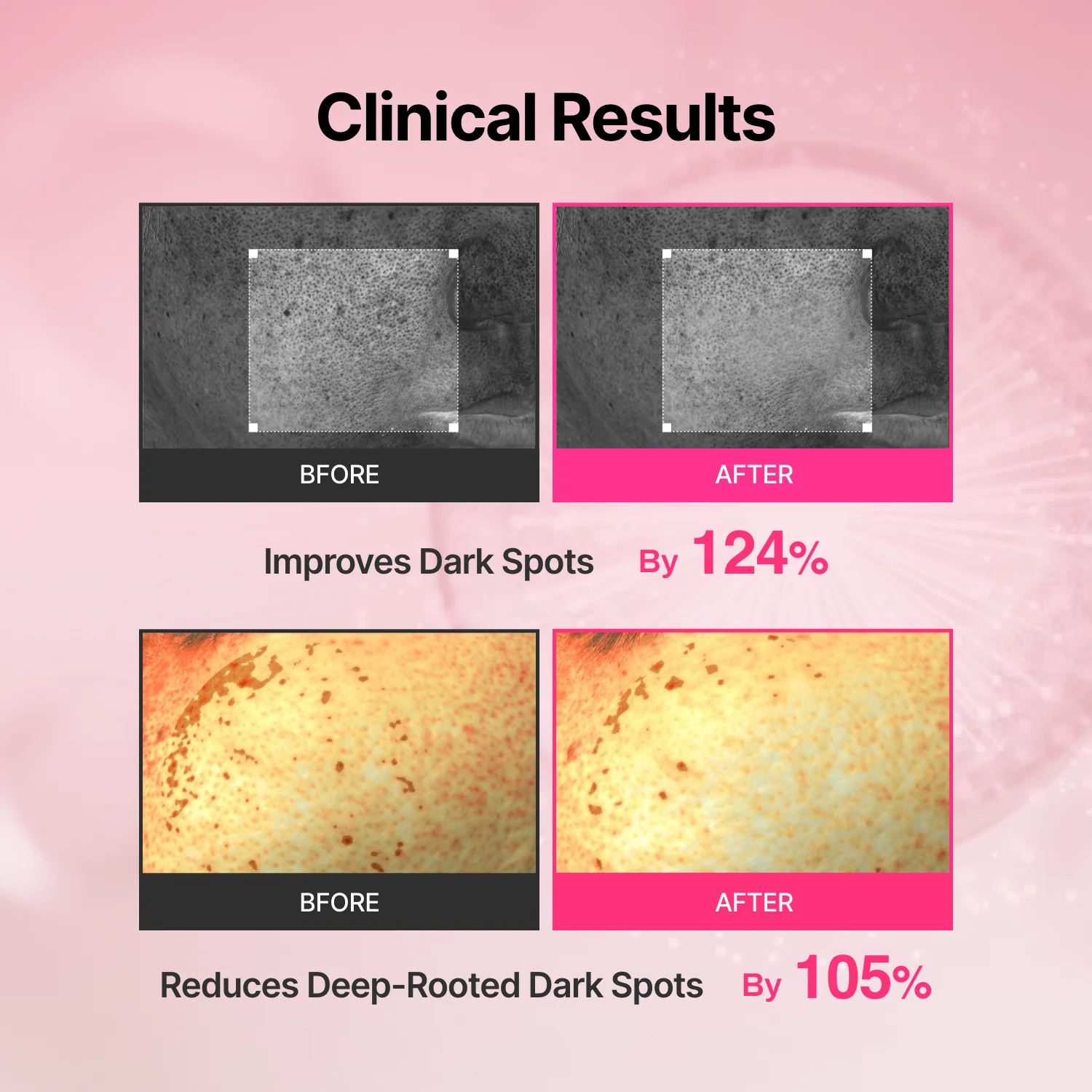 Tranexamic Acid Skin Booster Cream - Image 5