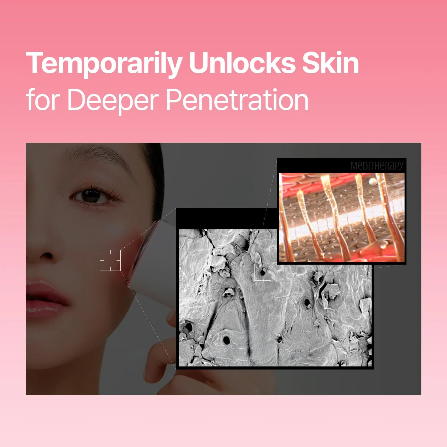Arbutin Skin Booster Serum – 10% Niacinamide, 2% Arbutin, Boosts Absorption 7x with Built-In Device - Image 3