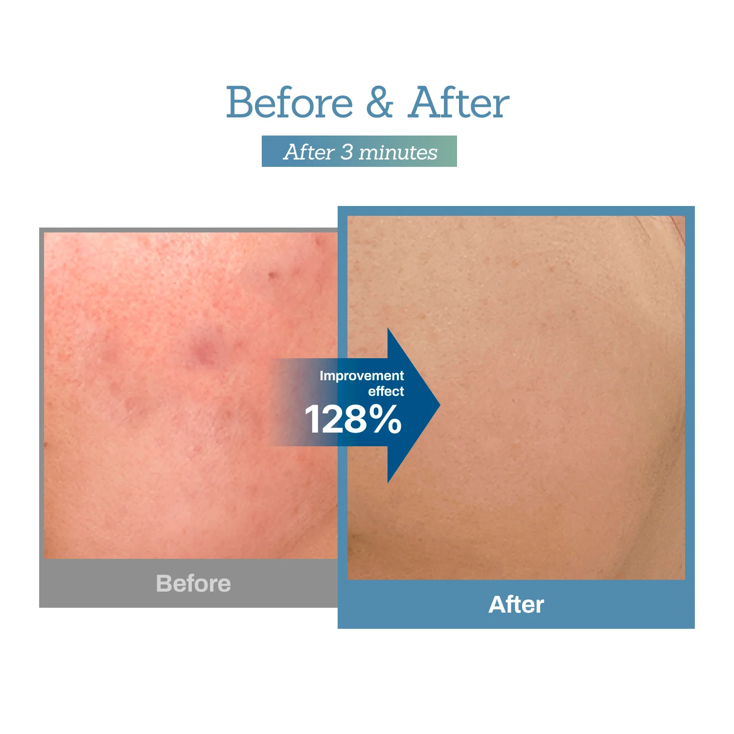 Blue Centella Calming Cream – Hydrating Korean Face Moisturizer for Sensitive Skin - Image 7