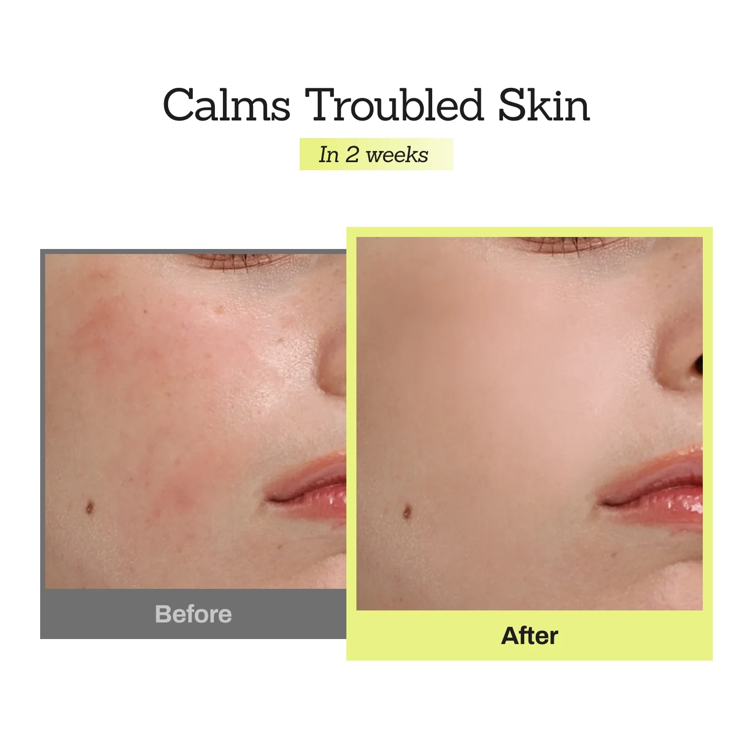 Mugwort Super Calming Toner + Serum - Image 15