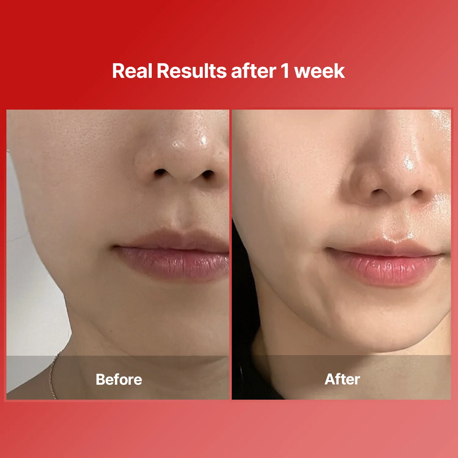 Shumage Gold Seal Cream + Device + Gold Seal Ampoule + Wrapping Mask - Image 29