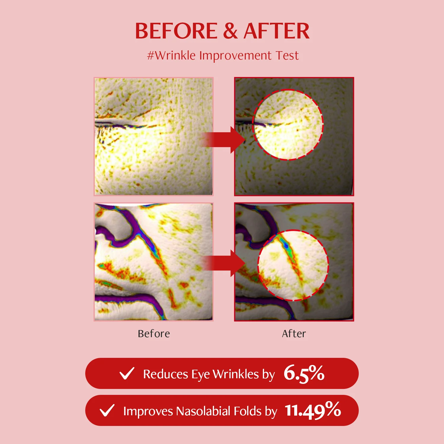 Shumage Shot Gold Seal Lifting Ampoule - Image 5