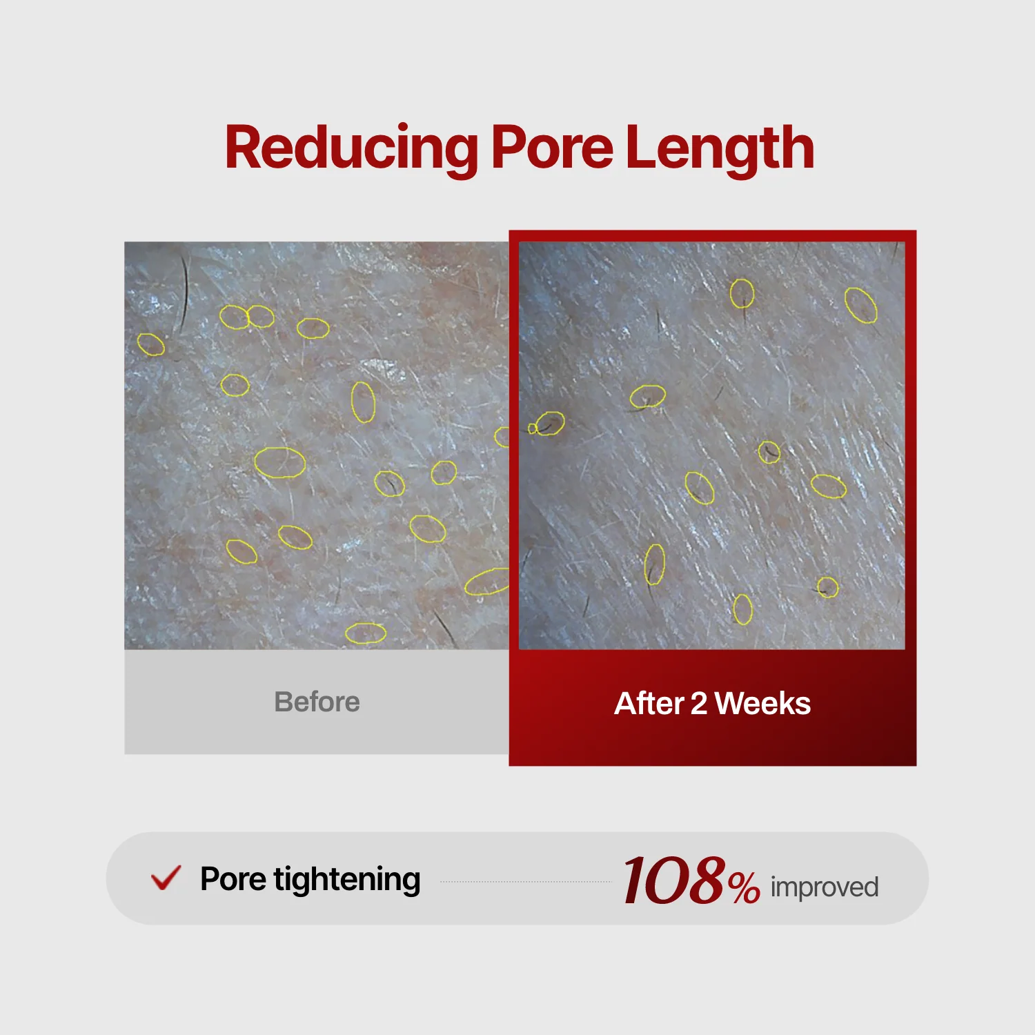 Wrinkle-fit Mask + Wrinkle-fit Neck Mask + Facial Roller - Image 12