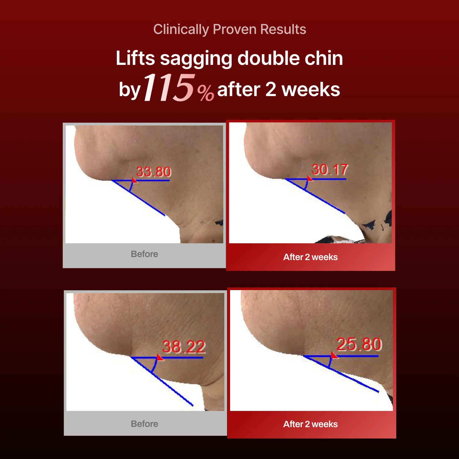 Wrinkle-fit Mask + Wrinkle-fit Neck Mask + Facial Roller - Image 4