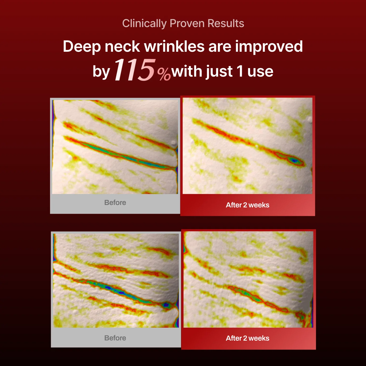 Wrinkle-fit Mask + Wrinkle-fit Neck Mask + Facial Roller - Image 5