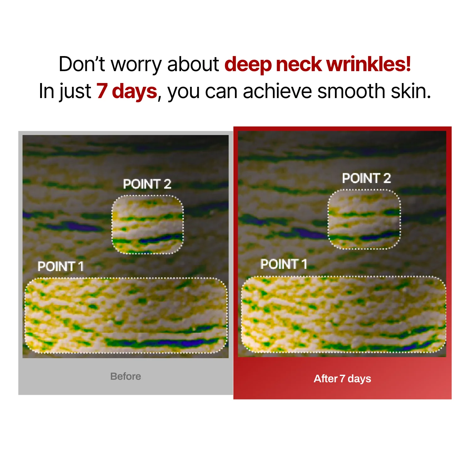 Wrinkle-fit Mask + Wrinkle-fit Neck Mask + Facial Roller - Image 13