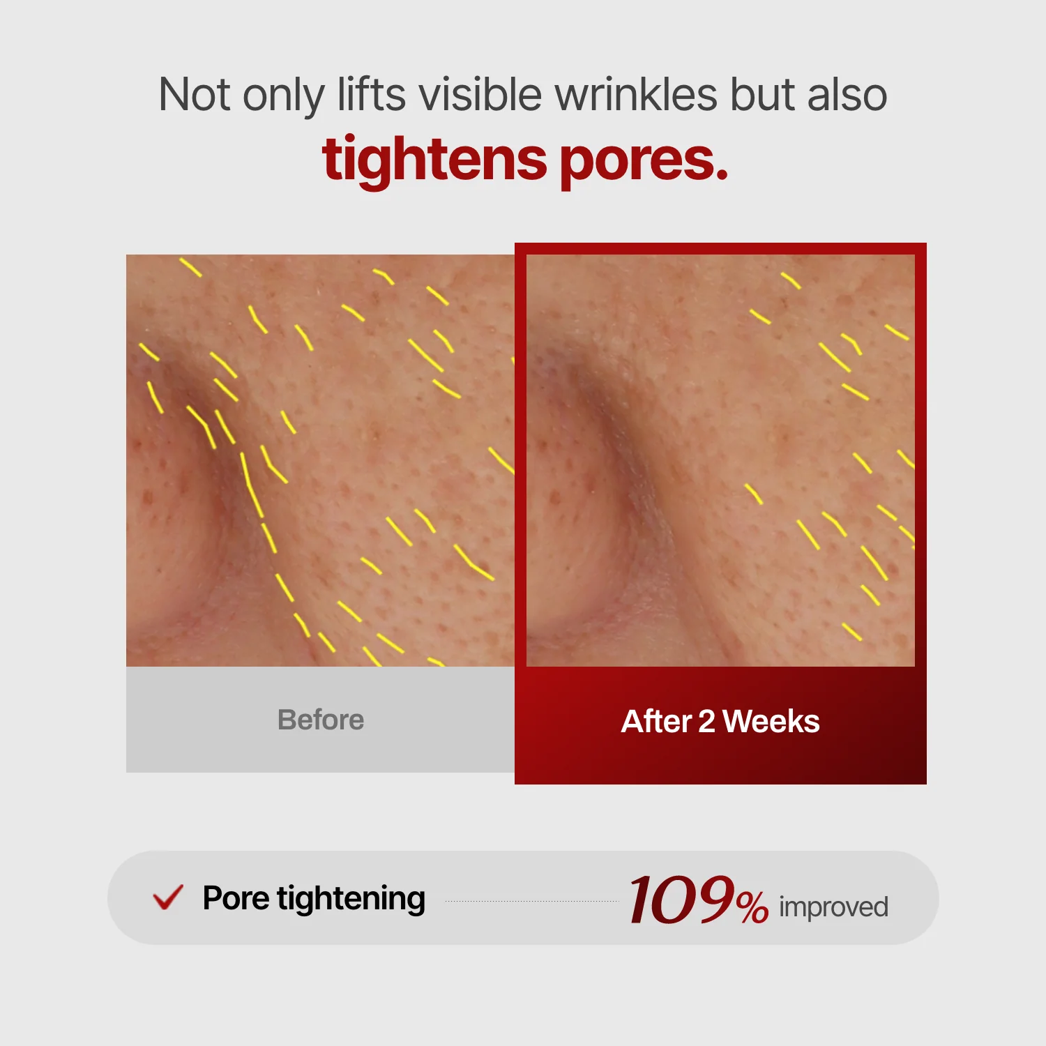 Wrinkle-fit Mask + Wrinkle-fit Neck Mask + Facial Roller - Image 15